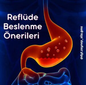 Reflü Semptomlarını Azaltmak İçin 8 Öneri